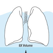 Dangers of Lung Overpressurization