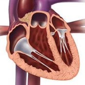 Coronal Bisection of the Heart